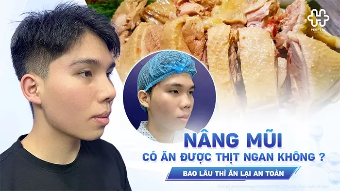 Nâng Mũi Có Ăn Được Thịt Ngan Không? Bao Lâu Thì Ăn Lại An Toàn