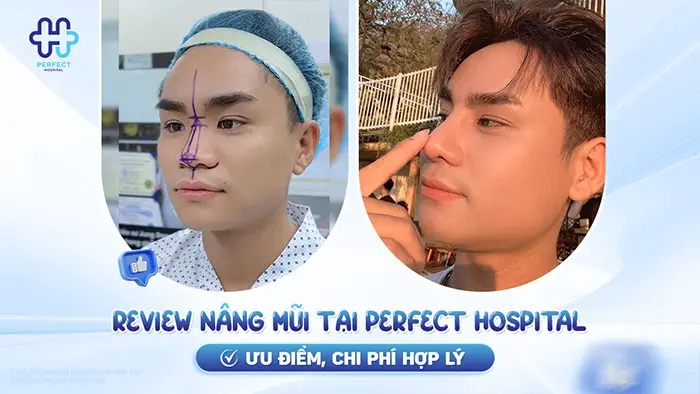Review Nâng Mũi Tại Perfect Hospital – Ưu Điểm, Chi Phí Hợp Lý