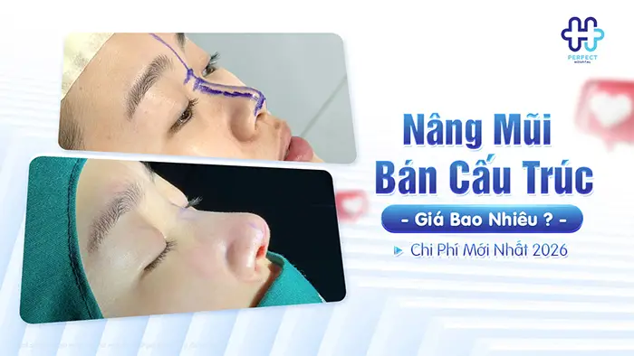 Nâng Mũi Bán Cấu Trúc Giá Bao Nhiêu? Chi Phí Mới Nhất 2026