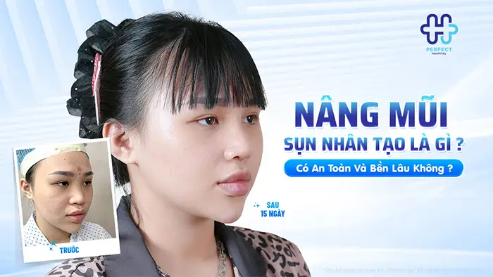 Nâng Mũi Sụn Nhân Tạo Là Gì? Có An Toàn Và Bền Lâu Không?