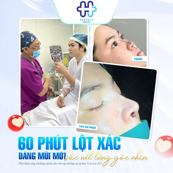 Bị Viêm Mũi Dị Ứng Có Nâng Mũi Được Không? Giải Đáp Chi Tiết