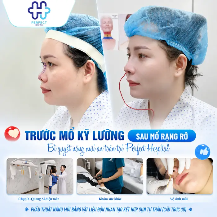 Bị Viêm Mũi Dị Ứng Có Nâng Mũi Được Không? Giải Đáp Chi Tiết