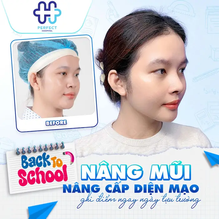 Tìm hiểu các phương pháp nâng mũi hiện nay ? Nên chọn loại nào phù hợp?