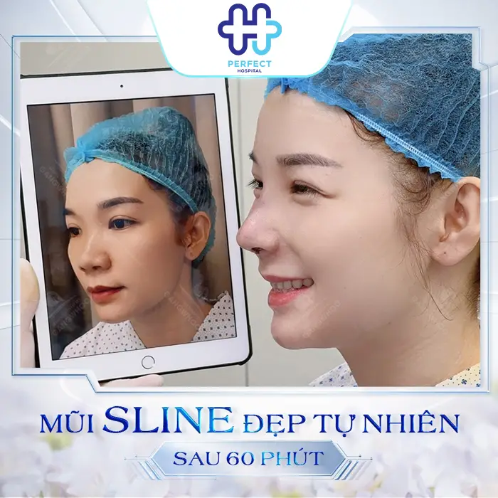 Tìm hiểu các phương pháp nâng mũi hiện nay ? Nên chọn loại nào phù hợp?