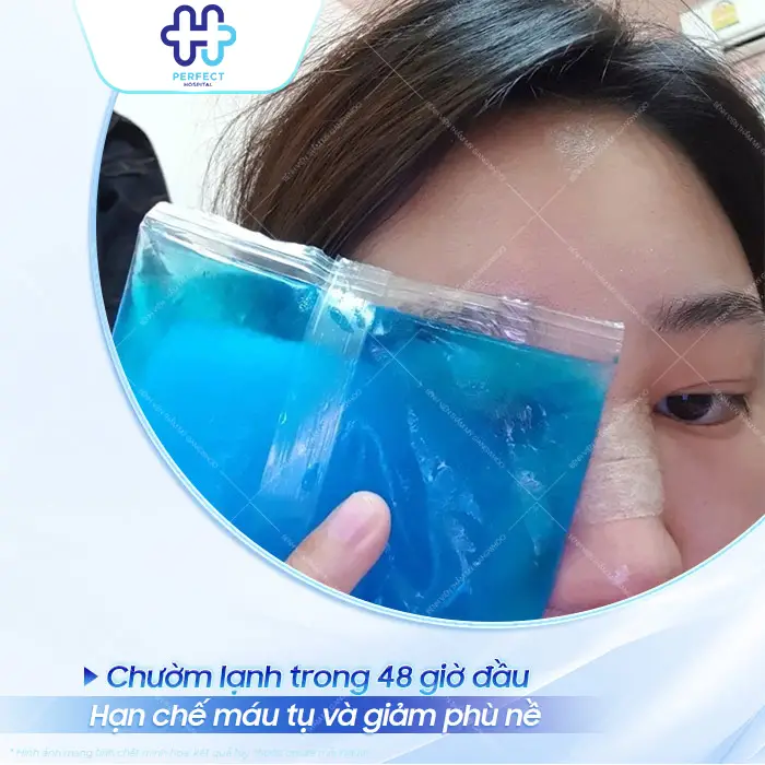 Cách Giảm Sưng Sau Nâng Mũi Hiệu Quả Giúp Mũi Nhanh Vào Form