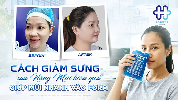 Cách Giảm Sưng Sau Nâng Mũi Hiệu Quả Giúp Mũi Nhanh Vào Form