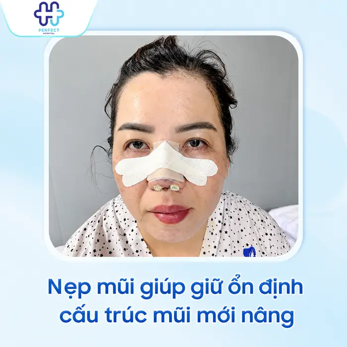 Cách Tháo Nẹp Nâng Mũi Đúng Cách Và Những Lưu Ý Quan Trọng