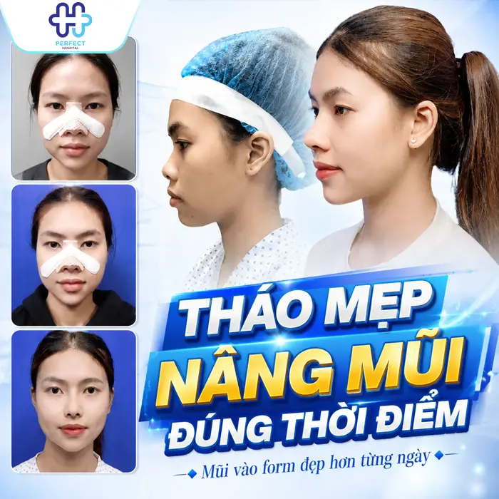 Cách Tháo Nẹp Nâng Mũi Đúng Cách Và Những Lưu Ý Quan Trọng