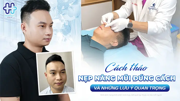 Cách Tháo Nẹp Nâng Mũi Đúng Cách Và Những Lưu Ý Quan Trọng
