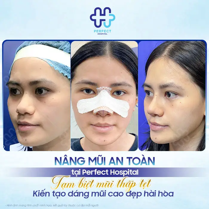 Cách Vệ Sinh Mũi Sau Khi Nâng Đúng Cách, Nhanh Hồi Phục