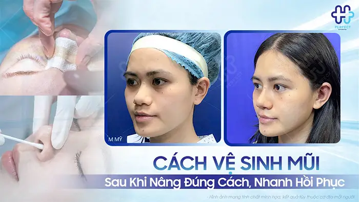 Cách Vệ Sinh Mũi Sau Khi Nâng Đúng Cách, Nhanh Hồi Phục