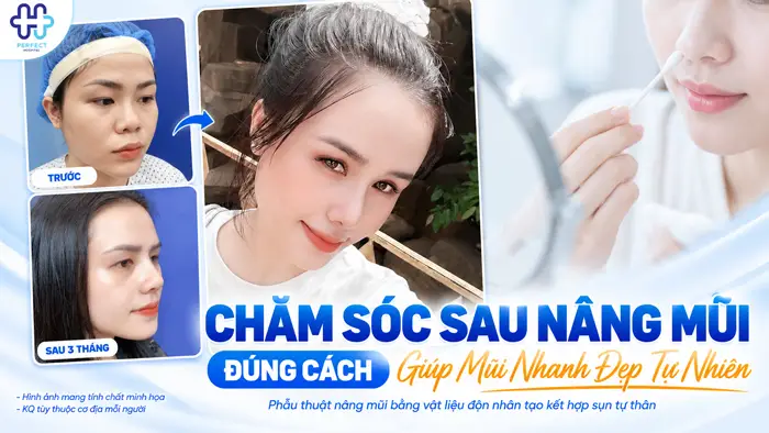 Chăm Sóc Sau Nâng Mũi Đúng Cách Giúp Mũi Nhanh Đẹp Tự Nhiên