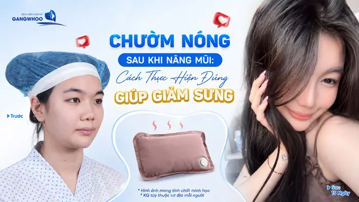 Chườm Nóng Sau Khi Nâng Mũi: Cách Thực Hiện Đúng Giúp Giảm Sưng