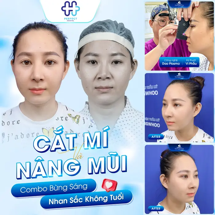 Có Nên Nâng Mũi Và Cắt Mí Mắt Cùng Lúc Không? Giải Đáp Chi Tiết