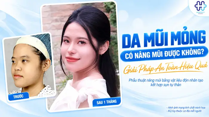 Da Mũi Mỏng Có Nâng Mũi Được Không? Giải Pháp An Toàn Hiệu Quả