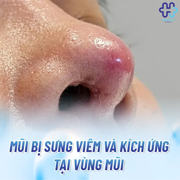 Dấu Hiệu Dị Ứng Chất Liệu Khi Nâng Mũi Và Cách Xử Lý An Toàn