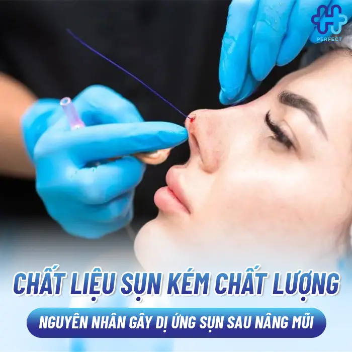 Dấu Hiệu Dị Ứng Chất Liệu Khi Nâng Mũi Và Cách Xử Lý An Toàn