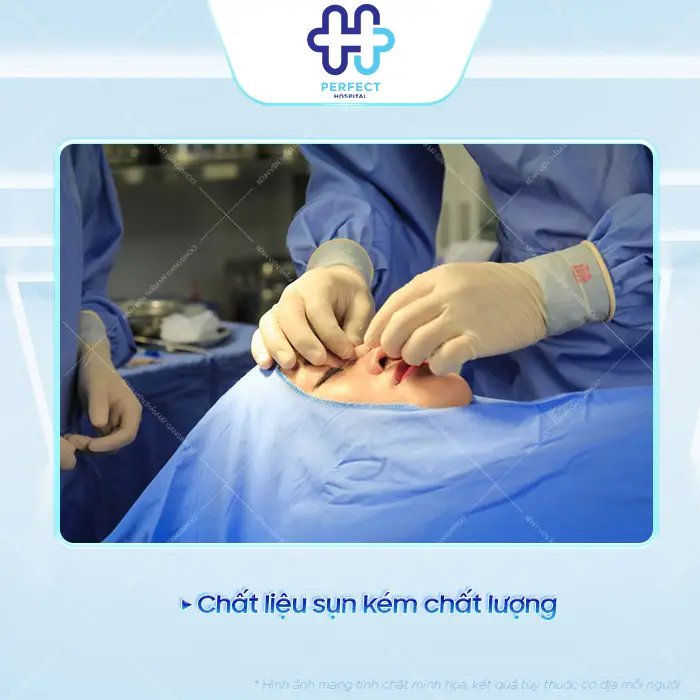 Dấu Hiệu Nhận Biết Mũi Tụt Sụn Sau Nâng Và Cách Xử Lý An Toàn