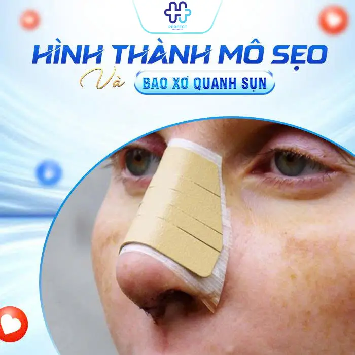 Đầu Mũi Bị Cứng Sau Nâng: Nguyên Nhân Và Cách Khắc Phục