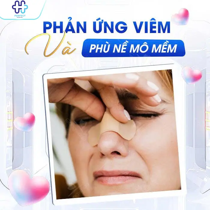 Đầu Mũi Bị Cứng Sau Nâng: Nguyên Nhân Và Cách Khắc Phục