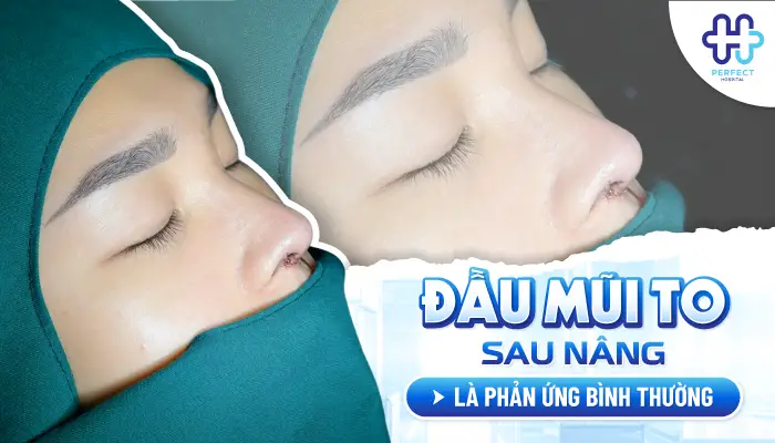 Đầu Mũi To Sau Khi Nâng: Nguyên Nhân Và Cách Xử Lý Hiệu Quả