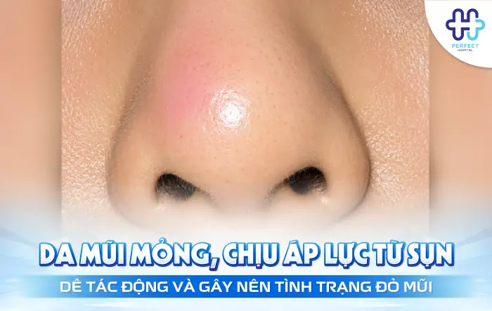 ĐỎ ĐẦU MŨI SAU KHI NÂNG: NGUYÊN NHÂN VÀ CÁCH XỬ LÝ AN TOÀN