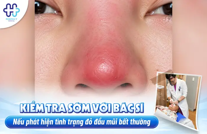 ĐỎ ĐẦU MŨI SAU KHI NÂNG: NGUYÊN NHÂN VÀ CÁCH XỬ LÝ AN TOÀN