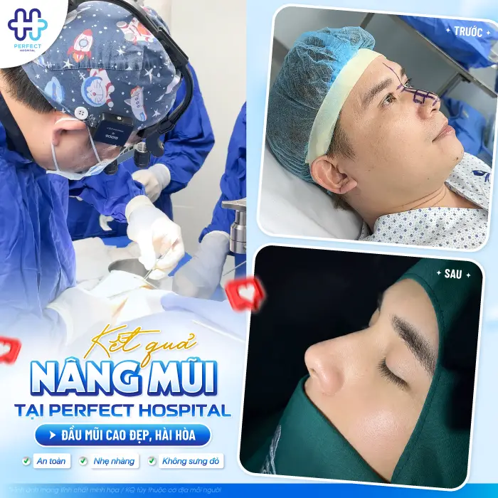 ĐỎ ĐẦU MŨI SAU KHI NÂNG: NGUYÊN NHÂN VÀ CÁCH XỬ LÝ AN TOÀN