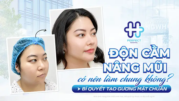 Nâng Mũi Độn Cằm Có Nên Làm Chung Không? Bí Quyết Tạo Gương Mặt Chuẩn