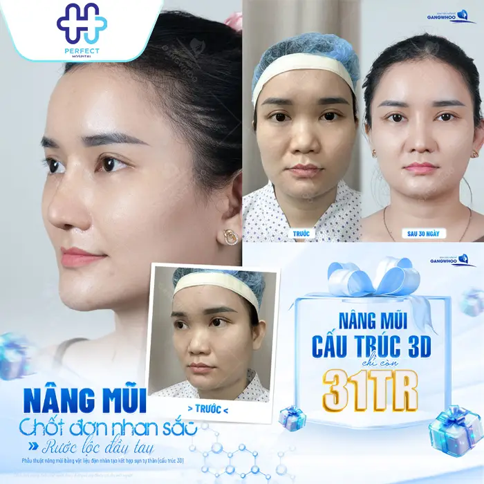 Nâng Mũi Cho Mặt Tròn: Chọn Dáng Mũi Phù Hợp Chuẩn Tỷ Lệ Vàng