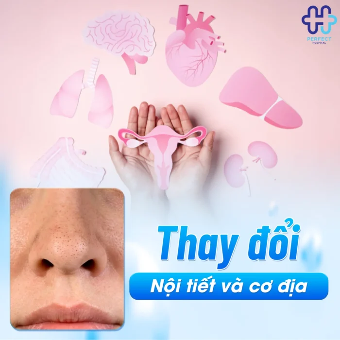 Mụn Đầu Đen Sau Khi Nâng Mũi: Nguyên Nhân Và Cách Xử Lý Hiệu Quả