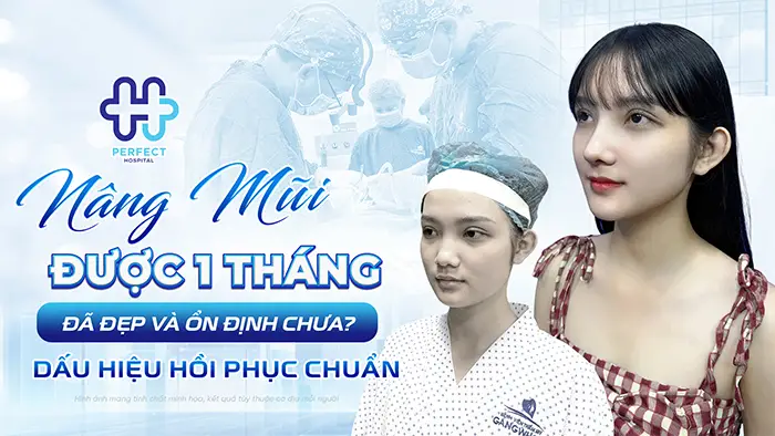 Nâng Mũi Được 1 Tháng Đã Đẹp Và Ổn Định Chưa? Dấu Hiệu Hồi Phục Chuẩn