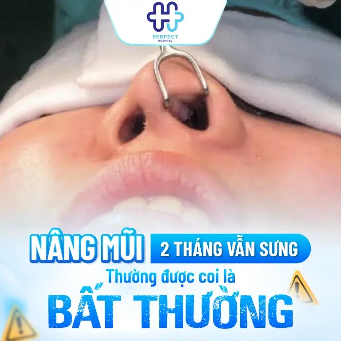 Nâng Mũi 2 Tháng Vẫn Sưng Có Sao Không? Nguyên Nhân Và Cách Xử Lý