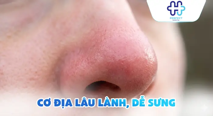 Nâng Mũi 2 Tháng Vẫn Sưng Có Sao Không? Nguyên Nhân Và Cách Xử Lý