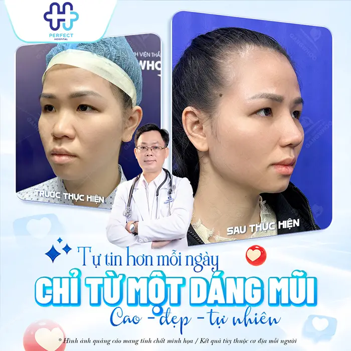Nâng Mũi Model 2D Hàn Quốc Là Gì? Có Nên Thực Hiện Không