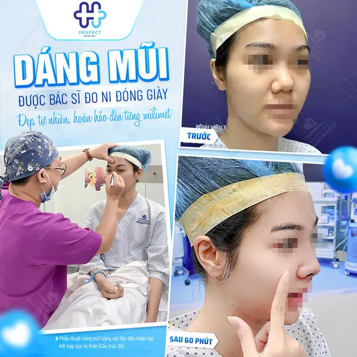 Nâng Mũi Model 2D Hàn Quốc Là Gì? Có Nên Thực Hiện Không