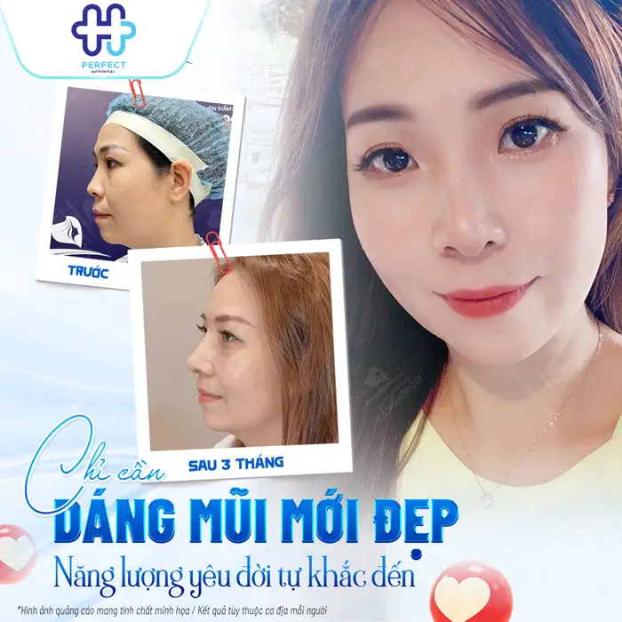 Nâng Mũi 6D Là Gì? Công Nghệ Tạo Dáng Mũi Chuẩn Tỷ Lệ Hiện Đại
