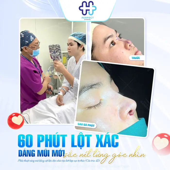 Nâng Mũi 6D Là Gì? Công Nghệ Tạo Dáng Mũi Chuẩn Tỷ Lệ Hiện Đại
