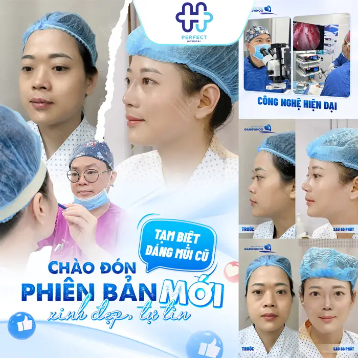 Nâng Mũi 6D Là Gì? Công Nghệ Tạo Dáng Mũi Chuẩn Tỷ Lệ Hiện Đại