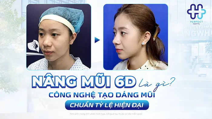 Nâng Mũi 6D Là Gì? Công Nghệ Tạo Dáng Mũi Chuẩn Tỷ Lệ Hiện Đại