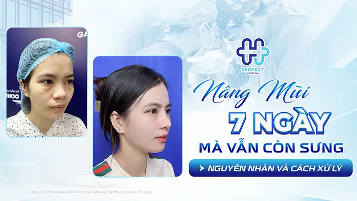 Nâng Mũi 7 Ngày Mà Vẫn Còn Sưng: Nguyên Nhân Và Cách Xử Lý