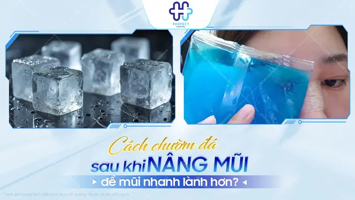 Nâng Mũi 7 Ngày Mà Vẫn Còn Sưng: Nguyên Nhân Và Cách Xử Lý