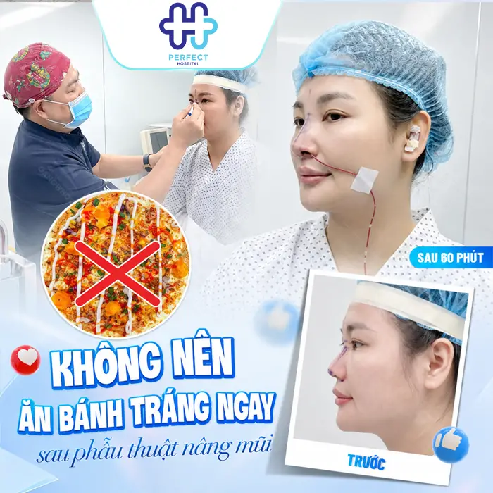 Nâng Mũi Ăn Bánh Tráng Được Không? Khi Nào Có Thể Ăn Lại?