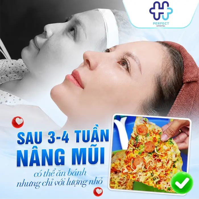 Nâng Mũi Ăn Bánh Tráng Được Không? Khi Nào Có Thể Ăn Lại?