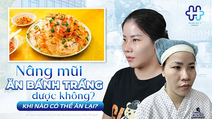 Nâng Mũi Ăn Bánh Tráng Được Không? Khi Nào Có Thể Ăn Lại?