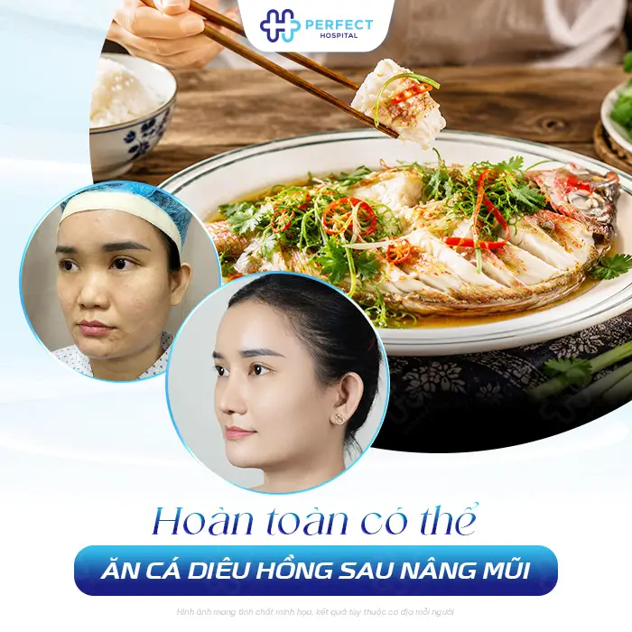 Nâng Mũi Ăn Cá Diêu Hồng Được Không? Khi Nào Nên Ăn Lại