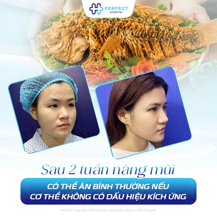 Nâng Mũi Ăn Cá Diêu Hồng Được Không? Khi Nào Nên Ăn Lại
