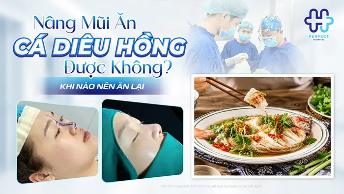Nâng Mũi Ăn Cá Diêu Hồng Được Không? Khi Nào Nên Ăn Lại