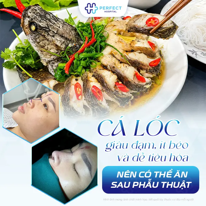 Nâng Mũi Ăn Cá Lóc Được Không? Khi Nào Nên Ăn Để Mau Lành