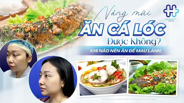 Nâng Mũi Ăn Cá Lóc Được Không? Khi Nào Nên Ăn Để Mau Lành